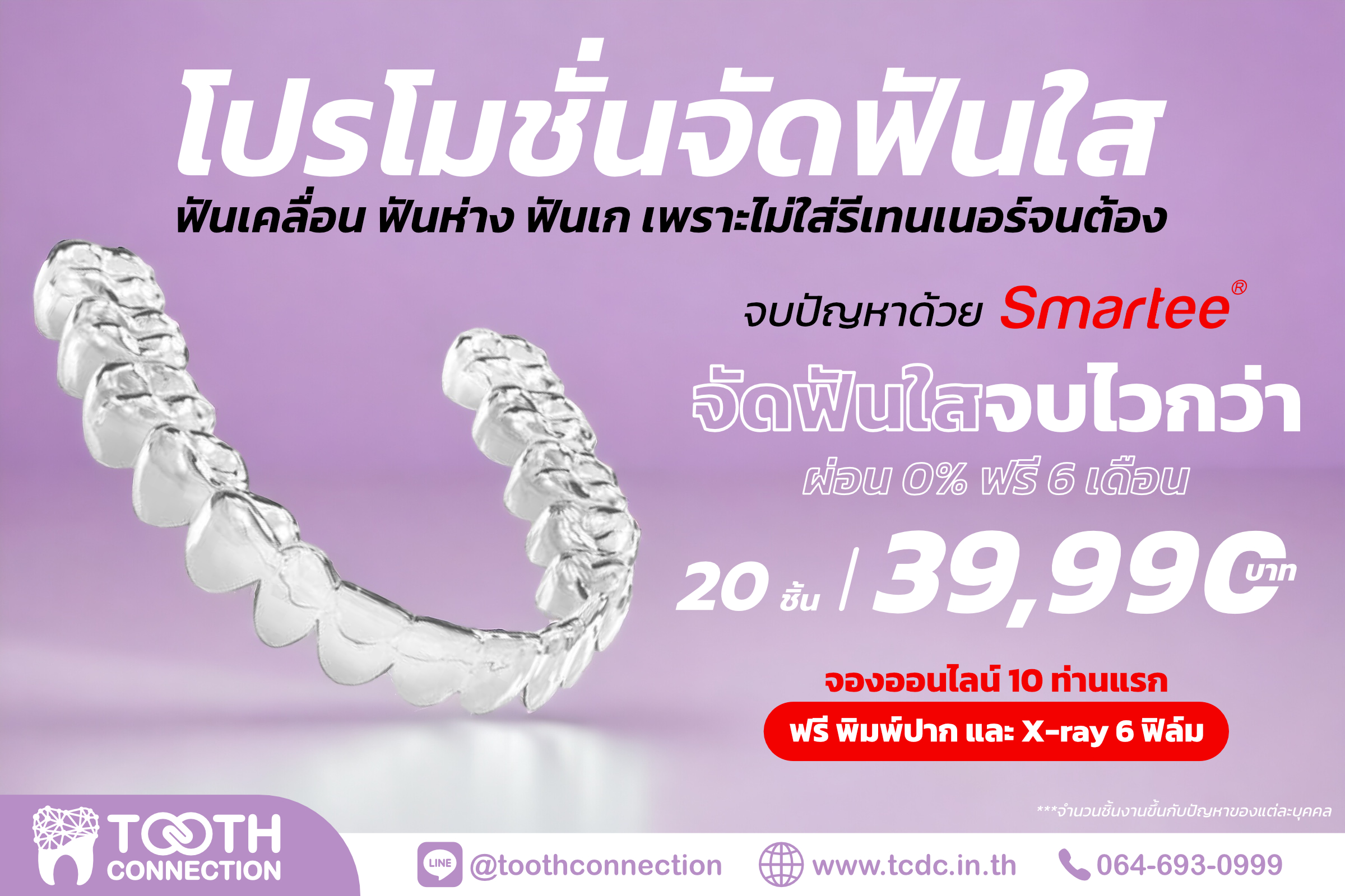 จัดฟันใส ภูเก็ต